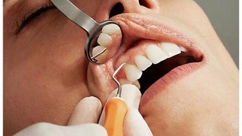 Seolah ada gigi di bibir. Foto: reddit.com/confusing_perspective