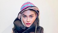 Foto Madonna Disebut Seperti Remaja 16 Tahun, Dikritik Kebanyakan Photoshop