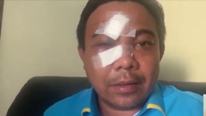 Ketua Umum (Ketum) KNPI Haris Pertama dipukuli orang tak dikenal (OTK) saat hendak makan di kawasan Cikini, Jakarta Pusat, Senin (21/2). Haris pun menduga ada dalang di balik pengeroyokan dirinya, sebab ia mengakui tidak pernah terlibat masalah dengan pelaku pengeroyokan.