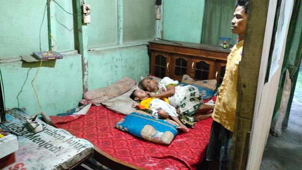 Anak yatim piatu di Probolinggo alami gizi buruk