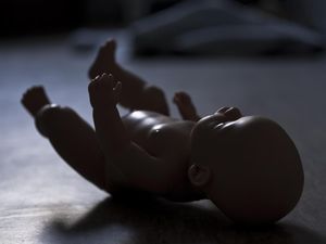 Geger Dokter Gigi di Bali Aborsi Ilegal Seribuan Wanita, PDGI-Kemenkes Buka Suara