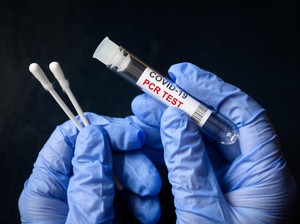 Dinkes Pastikan DKI Masih Aman dari COVID Subvarian Omicron EU.1.1