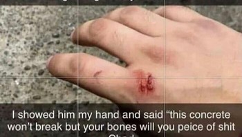 Salah fokus sama darah yang ada, kok mirip... saus? Foto: yeahthatdefinitelyhappened via Bored Panda