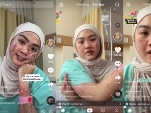 Kulit Wanita Bekasi Melepuh Usai Terpapar COVID-19, Ternyata Ini Sebabnya