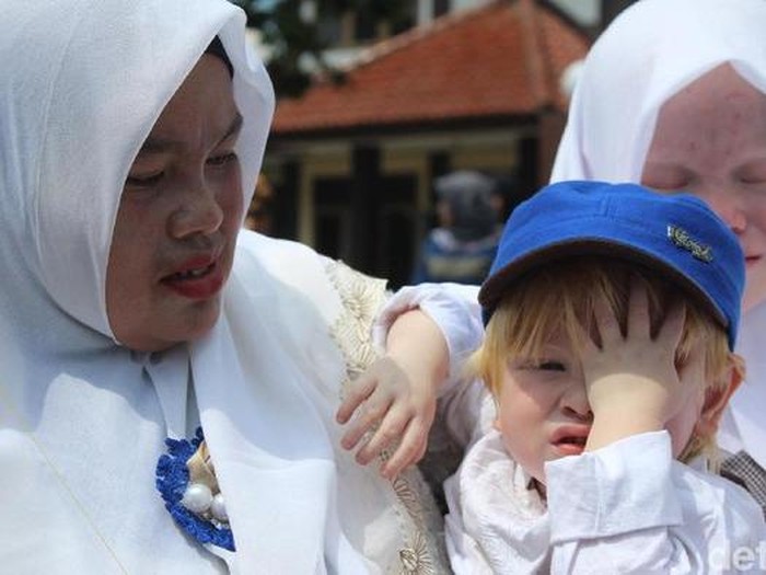 Kampung Albino di Ciburuy Garut
