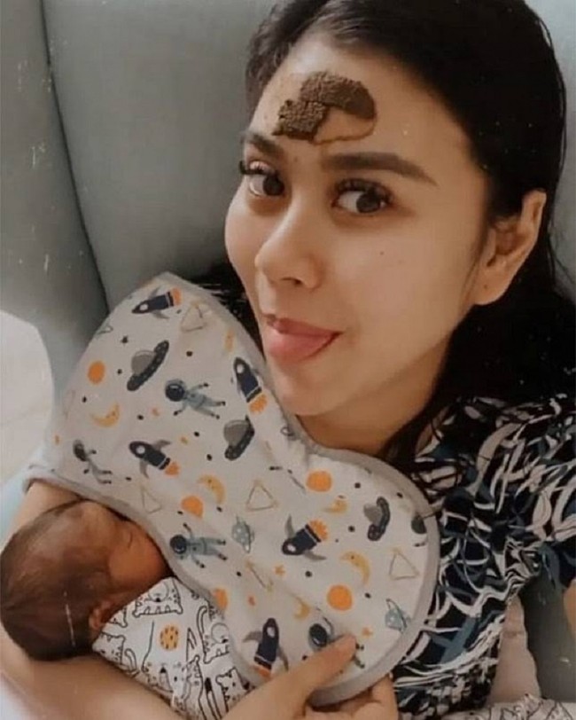 Setelah melahirkan anak kembar, adik dari Raffi Ahmad, Syahnaz Sadiqah juga tampak mengenakan pilis di dahinya. Budaya turun-temurun itu masih terus diikutinya. Seperti yang terlihat dalam foto, Syahnaz mengenakan pilis saat sedang menyusui bayinya. Foto: Instagram