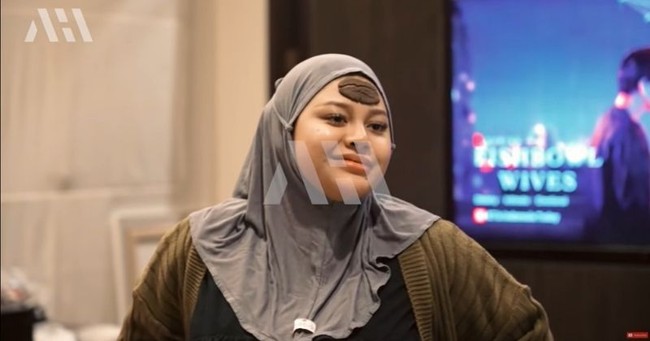 Terakhir ada artis yang baru lahiran, Aurel Hermansyah. Usai melahirkan anak pertamanya bersama Atta Halilintar, Aurel tampak mengenakan pilis di dahinya. Momen saat Aurel mengenakan pilis itu terlihat dalam video unggahan di akun YouTube AH. Bagaimana menurutmu penampilan Aurel saat mengenakan pilis? Foto: YouTube