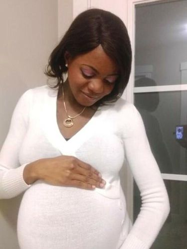 Anak Kembar Beda Warna Kulit