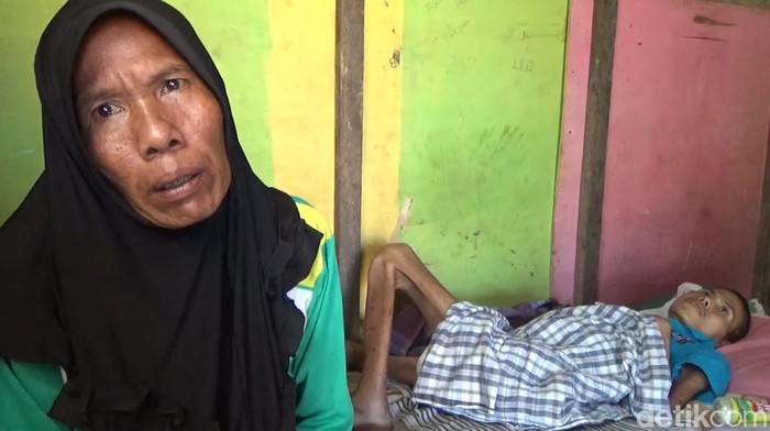 Pemuda Bengkulu Utara tak berdaya melawan penyakit tumor ginjal