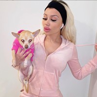 Stefanie sendiri saat ini sudah menjalani beragam prosedur operasi plastik, seperti di bibir, dagu, pipi, alis, dan juga rahang. Tak heran jika penampilan Stefanie sukses bikin pangling dan jauh berbeda dari sebelum dirinya melakukan operasi plastik. Foto: Instagram/@blondiesteffi