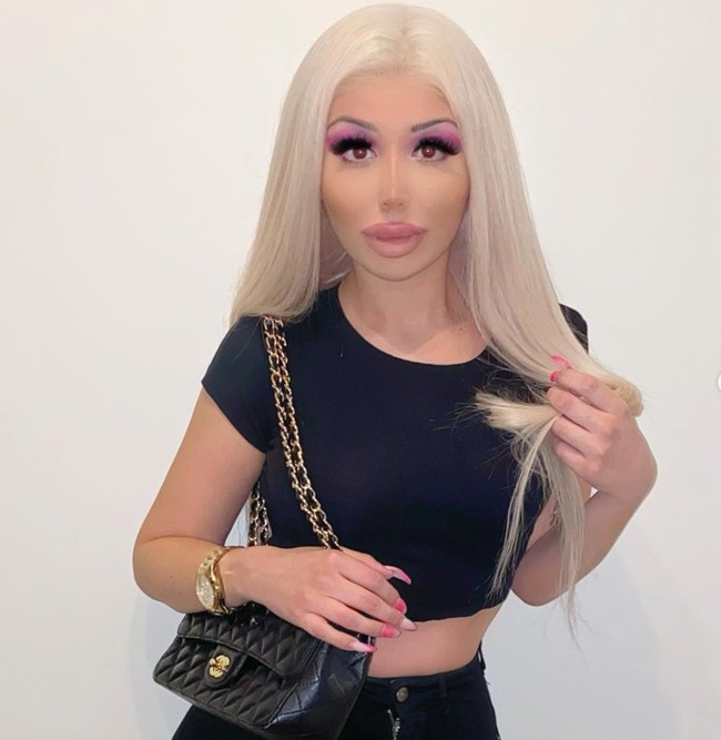 Walaupun sudah melakukan beragam operasi plastik namun  Stefanie masih berencana untuk menjalani oplas lanjutan demi bisa semakin mirip dengan boneka Bratz. Seperti, dirinya ingin melakukan facelift, implan bokong dan juga pinggul di masa depan. Foto: Instagram/@blondiesteffi