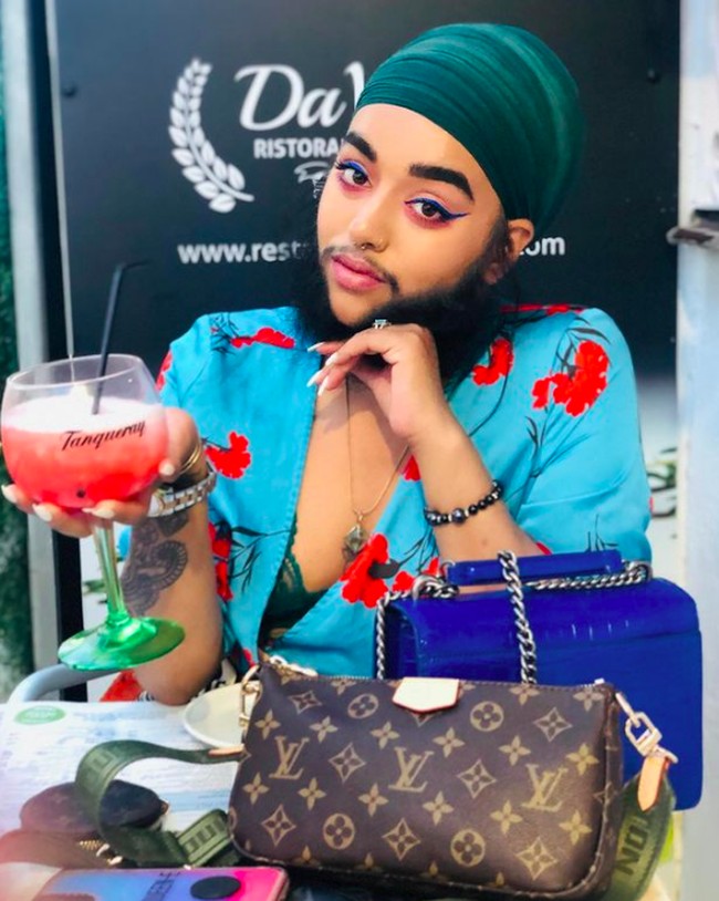 Di masa remaja, Harnaam mengalami masa-masa sulit karena dia menjadi korban bully karena penampilannya itu. Tak heran jika dulu dia rutin melakukan waxing bulu tubuhnya setiap dua minggu sekali. Foto: Instagram