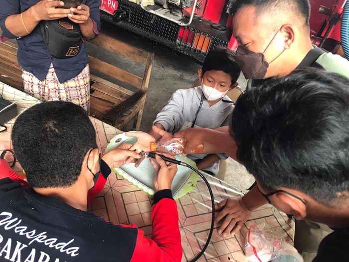 Petugas saat melepas cincin di jari bocah