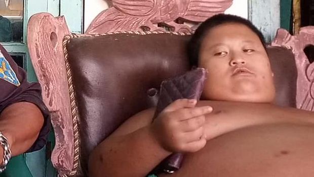 Bocah 11 tahun di Bekasi alami obesitas (Dok istimewa)
