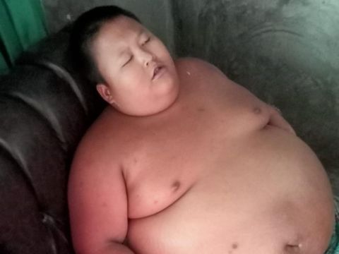 Bocah 11 tahun di Bekasi alami obesitas (Dok istimewa)