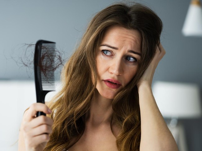 Woman Suffering From Hairloss Or Hairfall Problem