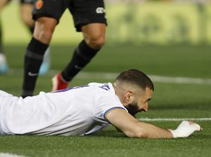 Benzema Malah Cedera Saat El Clasico Sudah di Depan Mata