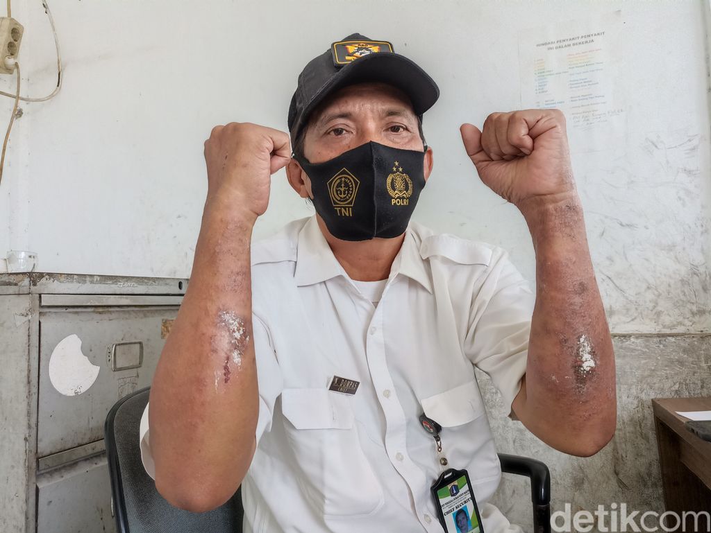 Warga Marunda, Jakut, mengeluhkan gangguan pernapasan hingga penyakit kulit diduga akibat pencemaran polusi abu batu bara. (Wildan Noviansah/detikcom)