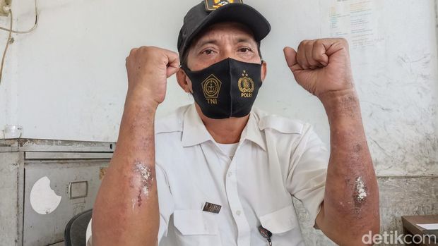 Warga Marunda, Jakut, mengeluhkan gangguan pernapasan hingga penyakit kulit diduga akibat pencemaran polusi abu batu bara. (Wildan Noviansah/detikcom)
