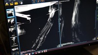 Anjing tersebut harus menjalani operasi untuk cedera serius pada kaki belakangnya.  