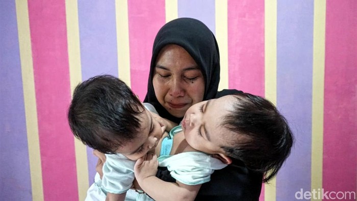 Bayi kembar siam dari Cikembar, Kabupaten Sukabumi