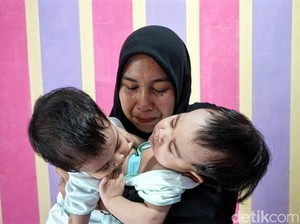 Tolong, Bayi Kembar Siam Asal Sukabumi Butuh Rp 1,6 M untuk Operasi