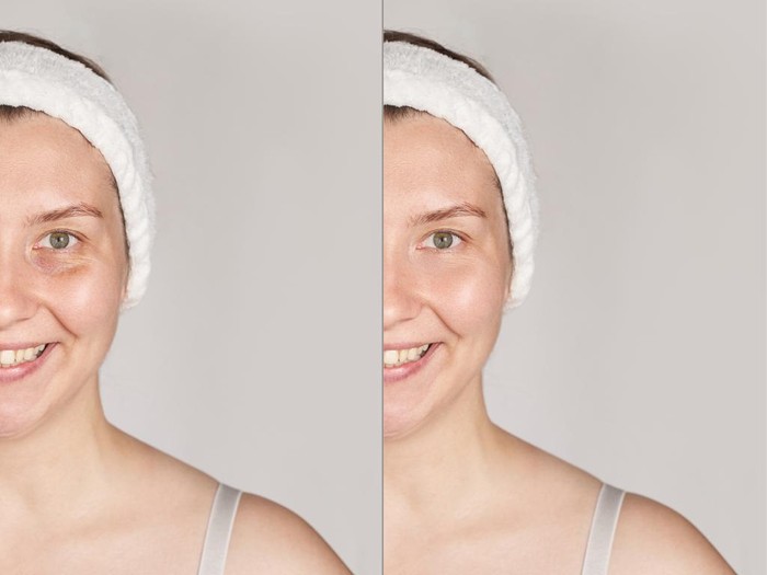 Cara menghilangkan kantung mata Pretty mature girl. Before and after portrait. Anti wrincle healthy therapy. Black circle under eyes. Collagen cream. Cosmetology rejuvenation. Beauty model. Procedure result.