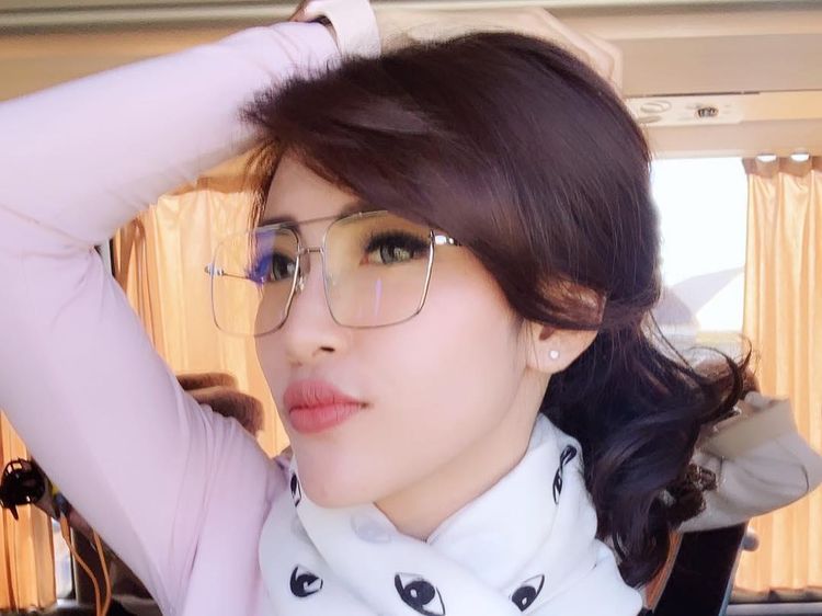 Ini Luka Lebam di Tubuh Citra Andy Usai Dilecehkan-Dianiaya Teman Suami Olla Ramlan