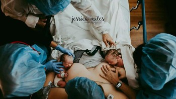 Twins First Latch karya Jessica Miles dari Amerika Serikat Foto: The International Association of Professional Birth Photographers
