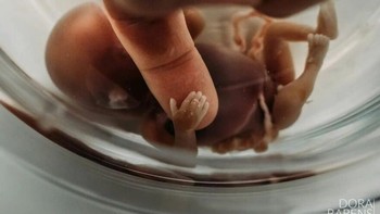 Touch Of Love karya Dora Barens dari Belanda Foto: The International Association of Professional Birth Photographers