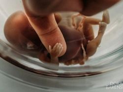 Bikin Merinding dan Nangis! Ini Karya Jawara Kontes Foto Persalinan