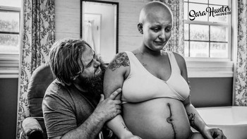 Persalinan penyintas kanker ovarium - karya Sara Hunter dari Amerika Serikat. Foto: The International Association of Professional Birth Photographers