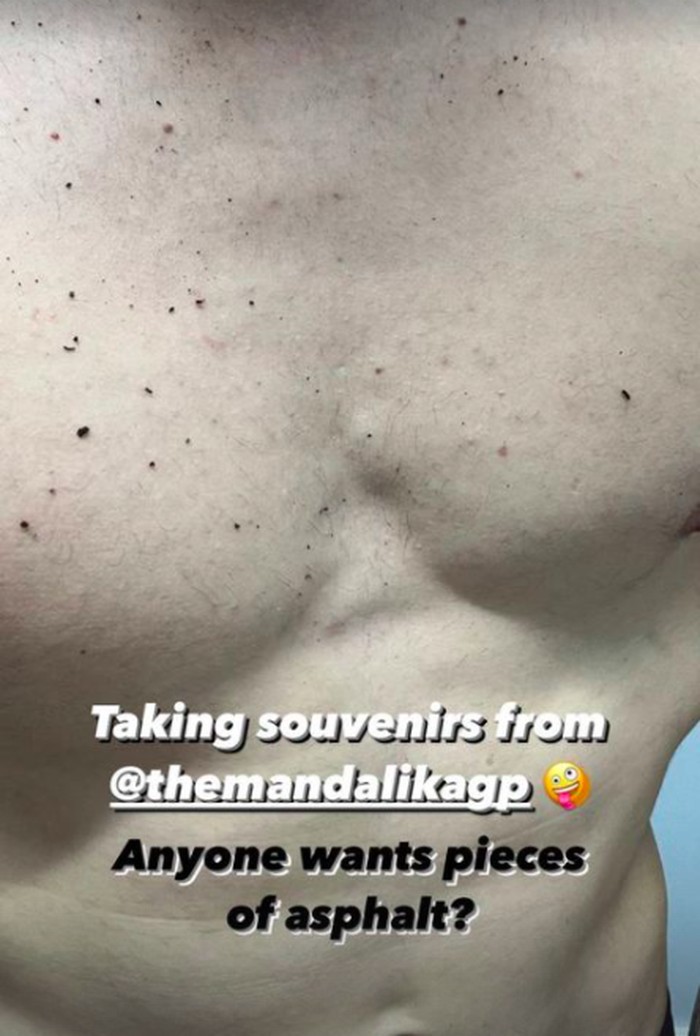 Alex Rins pamer dada terkena aspal Mandalika
