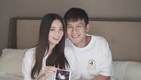 Momen keromantis mereka berdua sering diunggah ke akun Instagram @stellacor. Seperti momen mereka yang tersenyum bahagia memamerkan foto USG janin di kandungan Stella. Foto: Instagram @stellacor