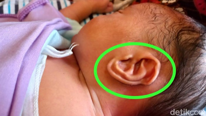 Unik! daun telinga bayi ini menyerupai lafaz Allah