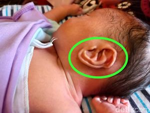 Daun Telinga Bayi di Karawang Disebut Mirip Lafaz Allah, Ini Penuturan Ortu