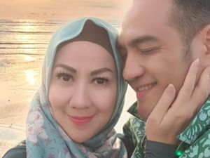 Venna Melinda Ngaku Alami Luka di Hidung Sampai Berdarah