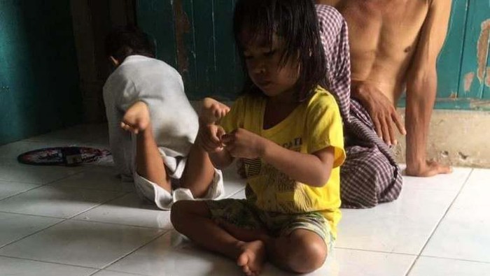 Annisa Muliadi, balita 4 tahun menderita penyakit jantung bocor.