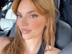 Bibir Kendall Jenner Jadi Tebal Seperti Kylie Jenner, Filler?