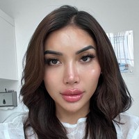 Millen Cyrus pun memperlihatkan wajahnya sesaat setelah suntik filler. Dia menjelaskan kalau saat ini wajahnya masih bengkak dan perlahan-lahan hasilnya akan lebih alami. Foto: Instagram/@millencyrus