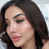 Perawatan suntik filler dilakukan untuk mendapatkan profil wajah yang lebih tegas. Ia menyebut prosedur tersebut sebagai ‘Millen’s contour Jolie’. Foto: Instagram/@millencyrus