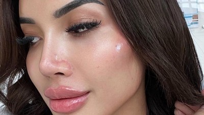 7 Foto Wajah Baru Millen Cyrus yang Suntik Filler Supaya Mirip Angelia Jolie