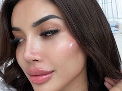 7 Foto Wajah Baru Millen Cyrus yang Suntik Filler Supaya Mirip Angelia Jolie