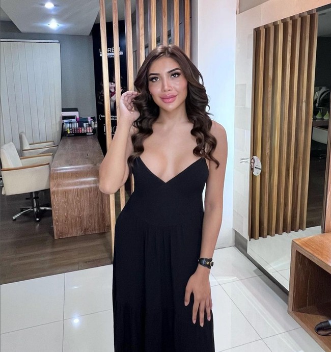 “Ini masih kondisi bengkak aja gini gimana udah natural,” tambahnya. Foto: Instagram/@millencyrus