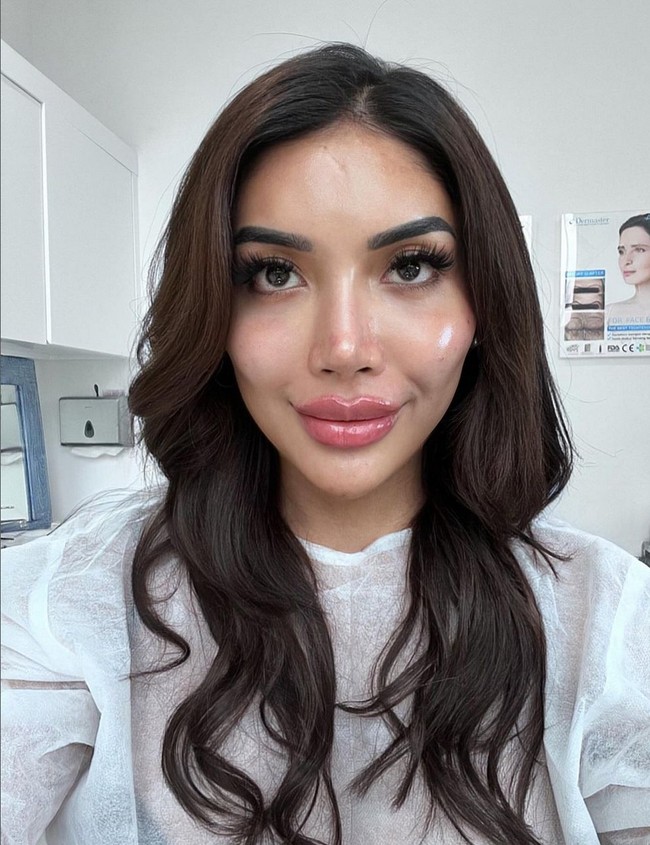 “Aku masih kaget dengan muka aku yang sekarang, sangat beda dan lebih cantik,” tulisnya dalam bahasa Inggris. Foto: Instagram/@millencyrus