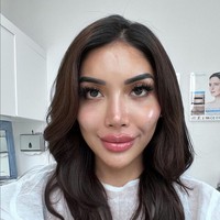 “Aku masih kaget dengan muka aku yang sekarang, sangat beda dan lebih cantik,” tulisnya dalam bahasa Inggris. Foto: Instagram/@millencyrus