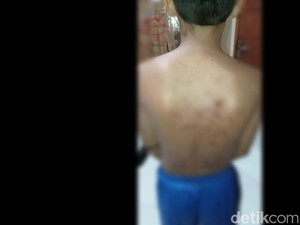 Dua Siswa SMP di Pasuruan Dianiaya Senior, Orang Tua Lapor Polisi