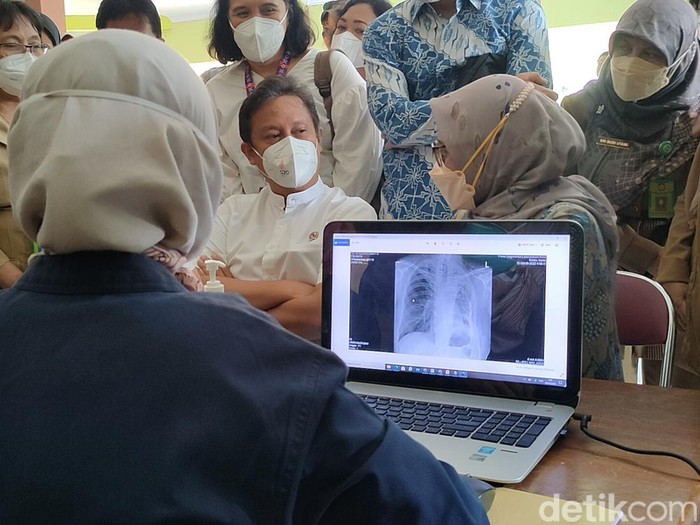 Menteri Kesehatan Budi Gunadi Sadikin meninjau pemeriksaan TBC di Puskesmas Girimulyo 1, Selasa (29/3/2022).