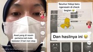 Viral Netizen Ngeluh Kedutan 3 Hari Non-stop, Ternyata Kena Penyakit Ini