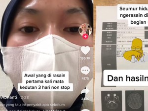 Viral Netizen Ngeluh Kedutan 3 Hari Non-stop, Ternyata Kena Penyakit Ini